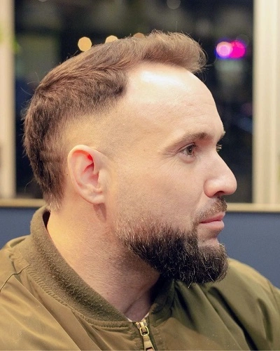 Mid Fade for Receding Hairline